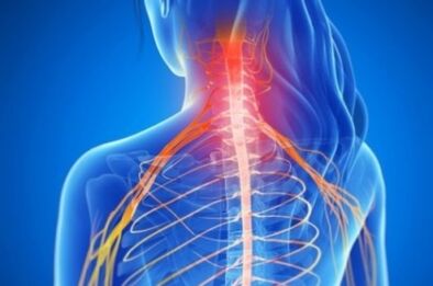 Rook Syndrome